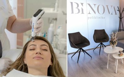 Tajne Dermatologa: Upoznajte Dermapen Microneedling, Mezoterapiju i Piling