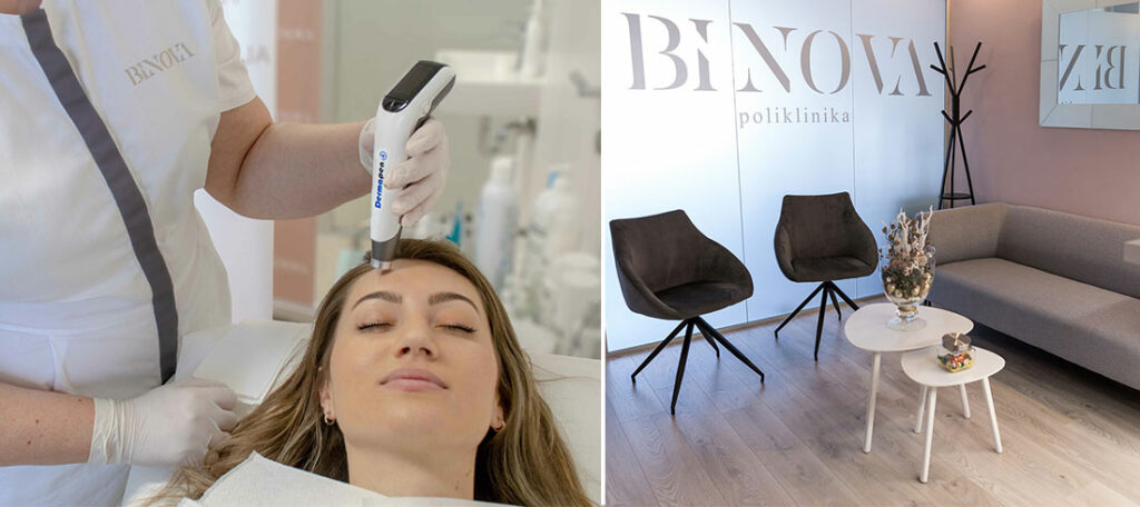 Tajne Dermatologa: Upoznajte Dermapen Microneedling, Mezoterapiju i Piling