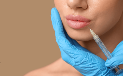 Diskretna elegancija: zašto je prirodno povećanje usana postalo simbol moderne estetike